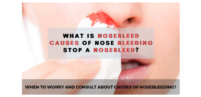 What is Nosebleed - Causes of Nose Bleeding – Stop a Nosebleed_