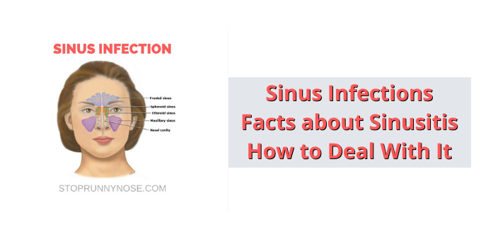 Sinus Infections Facts about Sinusitis How to Deal With It