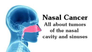 Nasal Cancer: All About Tumors of the Nasal Cavity & Sinuses