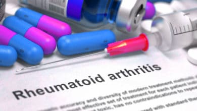 Natural Treatment for Rheumatoid Arthritis - Causes - Exercise & Supplements