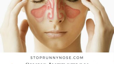 What You Need to Know About Sinus Infection